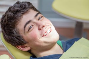 apparecchio per i denti