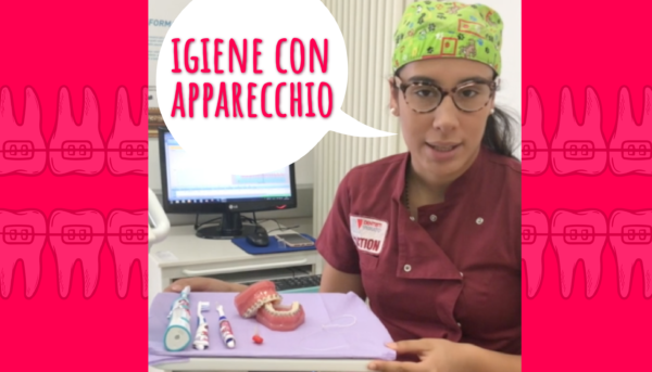 lavare i denti con l'apparecchio