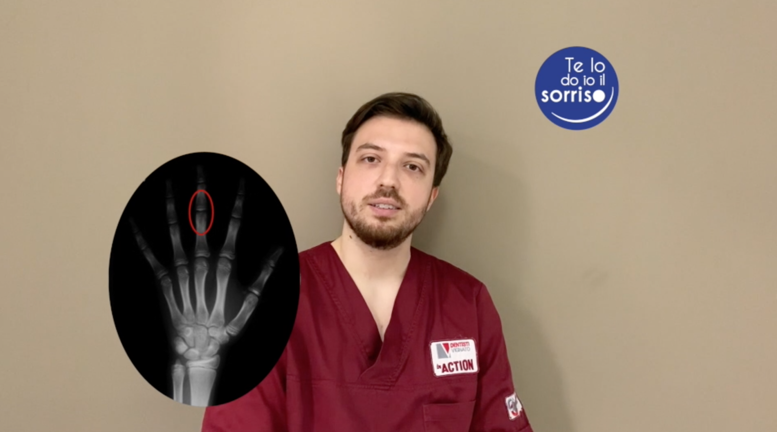 La radiografia al terzo dito della mano in ortodonzia